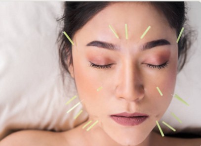 SYNERGIES - Auriculothérapie/ Ventouses/ Acu lift / Acupuncture / Énergétique chinoise, Praticien de Médecine Alternative à Louviers