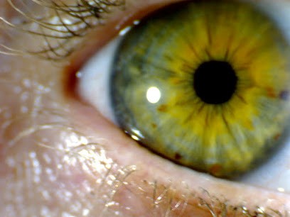 Joelle Chevrin Naturopathe Iridologue Sophrologue, Praticien de Médecine Alternative à Sèvres