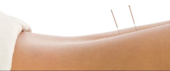 Audrey LAFORIE - Acupuncture Traditionnelle Chinoise Et Amaigrissement - ORTHEZ, Praticien de Médecine Alternative à Orthez